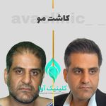 کلینیک تخصصی پوست و کاشت مو آوا
