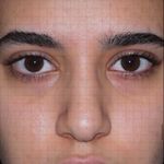 کلینیک زیبایی الماس کاملا اقساطی