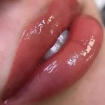 میکروکار حسین زاده