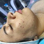 مرکز تخصصی فیشیال و مراقبت ازپوستsb,skin