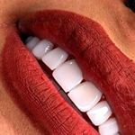 کلینیک دندانپزشکی خاورمیانه نقد و اقساط