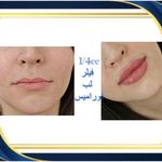 کلینیک پوست مو زیبایی هلیا