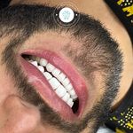 دندانپزشکی زیبایی دکتر محمد خسروی