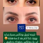 مطب پوست، مو و زیبایی دکتر مژگان طرزی