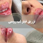 کلینیک زیبایی مهراز