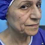 کلینیک زیبایی الماس کاملا اقساطی