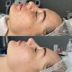 خدمات تخصصی پوست مریم همراه با اسپا صورت