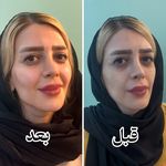 کلینیک زیبایی و لیزر باران در شهرری