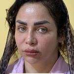 کلینیک زیبایی کاترین