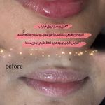 مرکز لیزر و کلینیک زیبایی پریفا