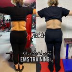 ایکسبادی - ای ام اس (EMS) پیروزی