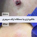 کلینیک زیبایی و لیزر سلن مشهد