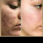 محصولات زیبایی پوست ومو  mnd-blakbery