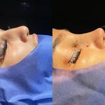 کلینیک زیبایی الماس کاملا اقساطی