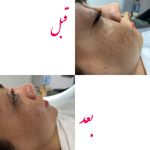 خدمات فشیال