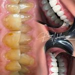 دندانپزشکی دکتر پریا آقاخانی،بیمه نداریم