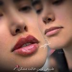 مرکز تخصصی لیزر باران