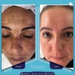 فیشیال و پاکسازی پوست تالگو فرانسه