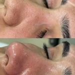 پاکسازی تخصصی پوست تارا ( فیشال تخصصی)