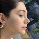 کلینیک زیبایی آفرینش،دکتر مهدی قهرمانیان