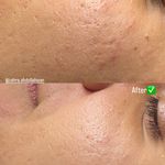 پاکسازی پوست و‌فیشال تخصصی زهراعبدالهیان