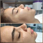 مرکز تخصصی فیشیال و مراقبت ازپوستsb,skin