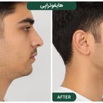 کلینیک زیبایی جوان بمانیم ۱۰٪ تخفیف