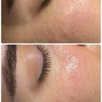 تزریق ژل و بوتاکس یکتا