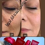 رازجوانی،با محصولات لدورا