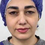 کلینیک زیبایی الماس کاملا اقساطی