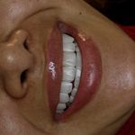 کلینیک‌دندانپزشکی دنتال آرنا-بیمه نیستیم