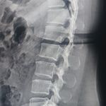 رادیولوژی و سونوگرافی پژواک