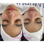 مرکز لیزر و فیشیال نیالا