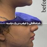 کلینیک زیبایی و جوانسازی پوست و مو الین