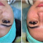 پاکسازی پوست و مو مهسام