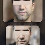کلینیک پوست،مو، زیبایی و لیزر بارانا