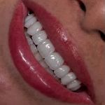 کلینیک‌دندانپزشکی دنتال آرنا-بیمه نیستیم