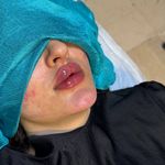 کیلینیک زیبایی آنابلا