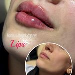 کلینیک زیبایی و مرکز لیزر هانیسا