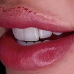 میکروپیگمنتیشن عارفه عارف نیا