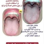 صدیقه زندیه مشاور ودرمانگر طب سنتی