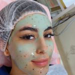 فشیال صورت و پاکسازی تخصصی