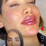 کلینیک تخصصی لیزر پوست مو مه سیما