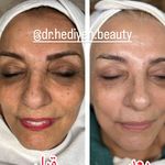 کلینیک زیبایی فشیال دکتر هدیه دهقان پور