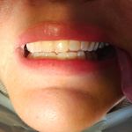 دندانپزشکی دکترآتنا اخوان