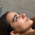 کلینیک تخصصی کاشت مو و ابرو رویش
