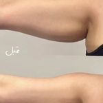 کلینیک تخصصی پوست و زیبایی ملینا