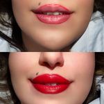 میکروبلدینگ ومیکروپیگمنتیشن حسینی