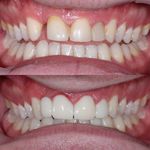 دنداپزشکی دکتر یاشار معزز