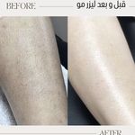 مرکز لیزر ،پوست و زیبایی کندی بیوتی